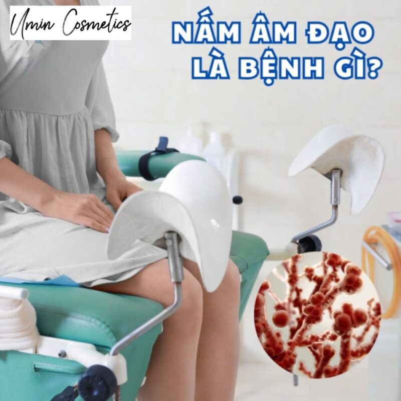 Nấm âm đạo